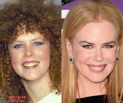 Nicole Kidman is an ageless beauty😍