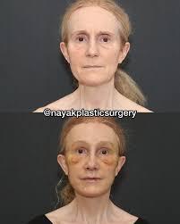 Nayak Plastic Surgery added a new...