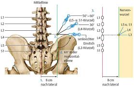Lendenwirbelsaule Lumbale Spinalnervenanalgesie Lspa