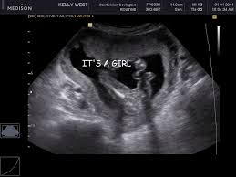 Cary And Kelly Gender Reveal It S A 17 Weeks