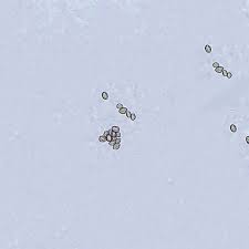 Image result for Microcoelia physophora