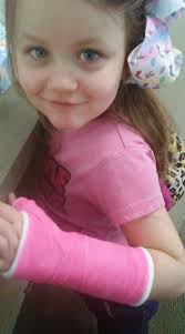Kid happy with cast after falling at home