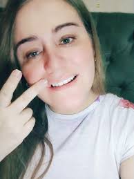 Superando la Parálisis Facial: Recuperando mi Sonrisa ❤️