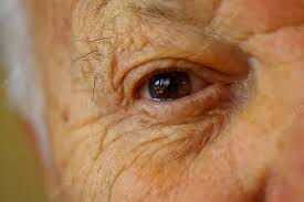 Image result for Rheum