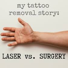 Though it is one of the cost: My Experience With Surgical Excision And Laser Tattoo Removal Procedures Tatring