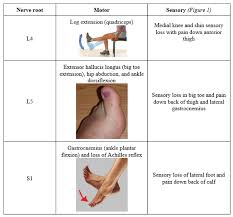 This herniated disk pain is in the lowest part of the back. An Mri Report Might List A Disc Herniation But The Report Often Adds Clinical Correlation Suggested What Are The Clinical Correlations Of A Herniated Disc Said To Compress The L4 L5 Or
