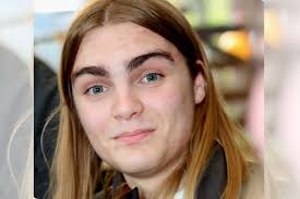 Essex teen, 17, diagnosed with rare form of bone cancer