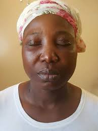 Photos: Ex-Workers allege poor conditions, unfair treatment in lawsuit