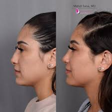 Nuance Aesthetics and Plastic Surgery