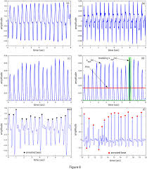 Check spelling or type a new query. Heart Rate Calculation Ecg Waveforms In Different Stages Of The Heart Download Scientific Diagram