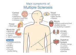 It affects the protective layer of nerves, called the myelin sheath, in your central nervous system — which comprises your brain and spinal cord. Exercise As A Countermeasure To Declining Central Nervous System Function In Multiple Sclerosis Physiospot Physiotherapy And Physical Therapy In The Spotlight