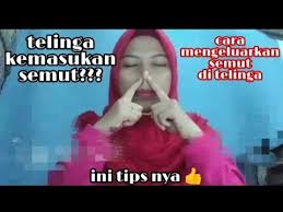 Dok bagaimana penanganan jika ada semut masuk ke telinga bayi. Cara Mengeluarkan Semut Dari Telinga Youtube