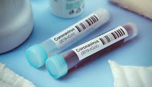 Características, plataformas, dosis, destinatarios y observaciones de todas las vacunas que estamos distribuyendo en el país. Actualmente Hay 20 Vacunas En Desarrollo En Todo El Mundo Frente Al Coronavirus El Medico Interactivo