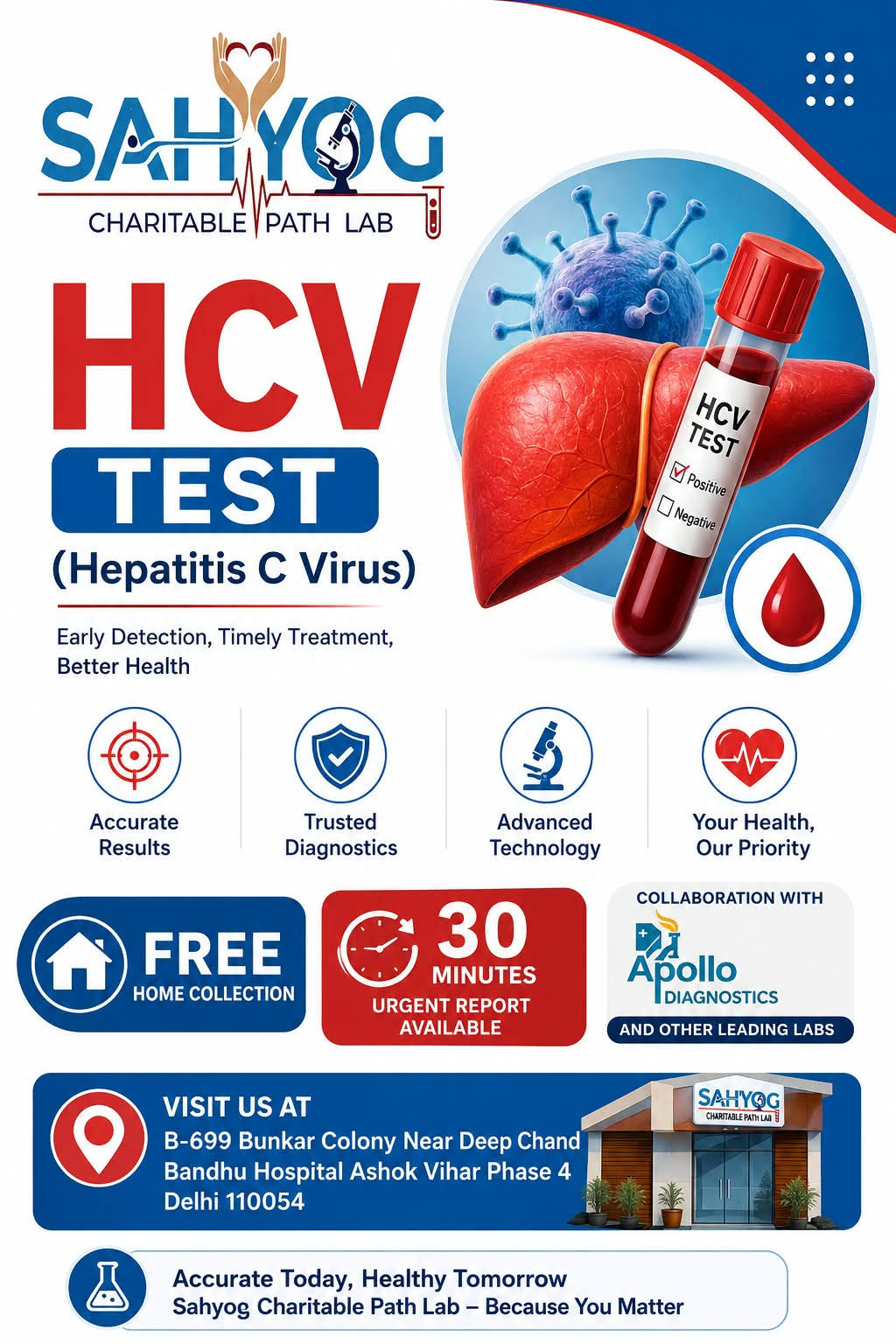 HCV (HEPATITIS C VIRUS) TEST