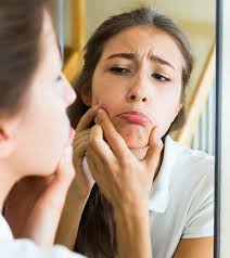 A good treatment for dandruff and dry scalp. How To Use Jojoba Oil For Acne