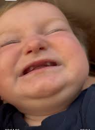 did jen mccabe get new teeth