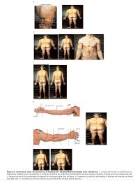 Anatomical Sites For Practicing Wet Cupping Therapy Al