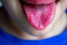 We did not find results for: Scarlattina Nei Bambini Cause Sintomi E Diagnosi Della Malattia