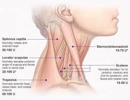 Cervical Dystonia Google Search Backpain Muscle Spasms In Neck Cervical Muscle Spasms