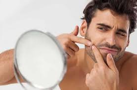 Saat ini media sosial sering di manfaatkan oleh perusahaan besar untuk lebih dekat dengan pelanggan mereka. Wajah Mulus Bebas Jerawat Ini Cara Merawat Wajah Pria Yang Berjerawat