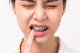 Pioneering Women in Orthodontics: Shaping the Industry