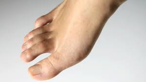 ● avoir (toujours) le/un pied en l'air, le/un pied levé, le/un pied qui remue : Les Cors Aux Pieds