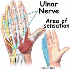The pain may be constant or only appear when you move your wrist or apply pressure to it. My Ring And Pinky Finger Sometimes Close Up And Become A Little Numb Why Is That And How Can I Fix It Nonsurgically Quora