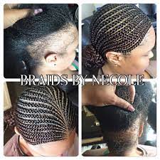 And if the cause is an. 14 Extraordinary Alopecia Camouflage Cornrows By Braids By Necole Cornrows Braids For Black Women Cornrows Braids Black Women Hair Loss