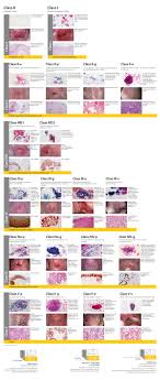 These symptoms could also be signs of other health problems, not related to cervical cancer. Secondary Prevention Of Cervical Cancer