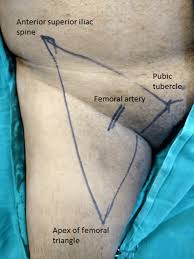 Posted on january 20, 2015 by admin. Diagram Male Groin Diagram Full Version Hd Quality Groin Diagram Diagramist Andrearossato It