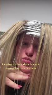 Having Hair Is A Privilege Sene
