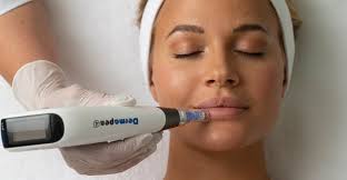 Microneedling is a minimally invasive treatment designed to reduce the look of scars, wrinkles, and microneedling works by making controlled microinjuries in your skin, which your body will then heal. Microneedling Your Complete Guide To The Skin Treatment Everyone Is Talking About Beauty Editorialist