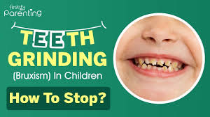 Maybe you would like to learn more about one of these? Teeth Grinding Bruxism In Children Causes Symptoms Treatment Youtube