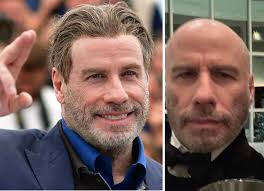 L'attore comico ha ricevuto un trattamento per il trapianto di capelli. John Travolta Rinuncia Al Parrucchino E Si Mostra Calvo Su Instagram E Boom Di Like Io Donna