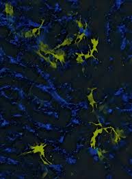 Effets secondaires de l immunoth?rapie. Cancer Des Immunotherapies Sans Effets Secondaires Eurekalert Science News