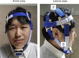 Jaw-Opening Force Test to Screen for Dysphagia: Preliminary Results