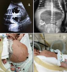The Pan African Medical Journal Image Quiz