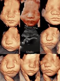 Auralogy report for 1 month Contact trupti prajapati