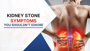 Kidney Stone Symptoms You Shouldn't ...