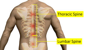 Musclesm in the upper human back. What Causes Pain Around The Ribs And Back Symptoms Regenexx