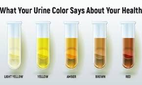 Just One Lemon For The Private Parts Here Is What Happens Proud American Color Of Urine Urinal Health