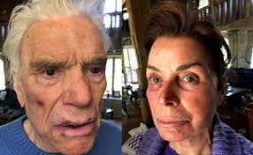 Bernard tapie was born on january 26, 1943 in paris, france. My Wife Lost Sleep Bernard Tapie Talks About His Burglary In Seine Et Marne The Limited Times