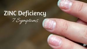 Image result for Zinc Deficiency