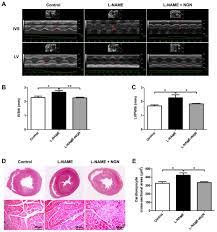 Naringenin Inhibits Ng Nitro L Arginine Methyl Ester Induced Hypertensive Left Ventricular Hypertrophy By Decreasing Angiotensin Converting Enzyme 1 Expression