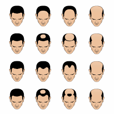 Search how to make hair fuller. How To Make Your Hair Thicker Male Hair Loss Solutions Maxim Online