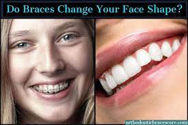 Massage each part of your nose, starting from the bridge, to the tip, and then finally the sides. Do Braces Change Your Face Shape Orthodontic Braces Care