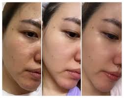 推坑笔记】拯救膚色不均！獨家Bifidm活菌添加Double Doctor焕采润白精华霜