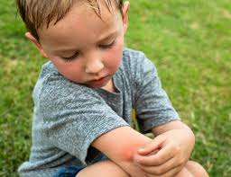 Box Fan: The Unsung Hero in Your Mosquito Battle