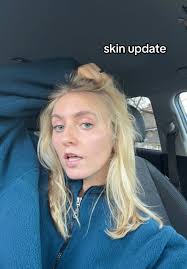 #facerealityskincare #facereality #acnebootcamp #acnejourney #skincare  #esthetician