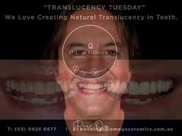 “Translucency Tuesday”, We...